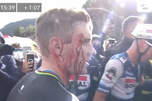 <p>Remco Evenepoel’s face is bloodied following the incident</p>